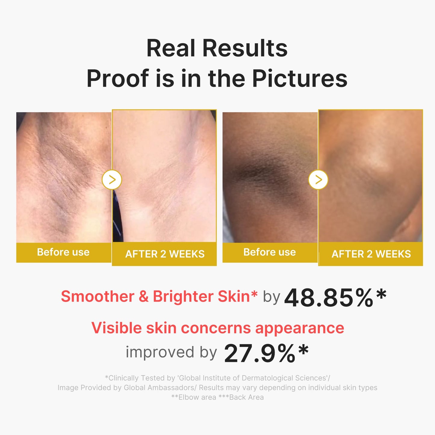 kojic-acid-turmeric-body-peel-shot-i6 02_72880cfc-382b-440b-8152-7e3dce87da2a.jpg