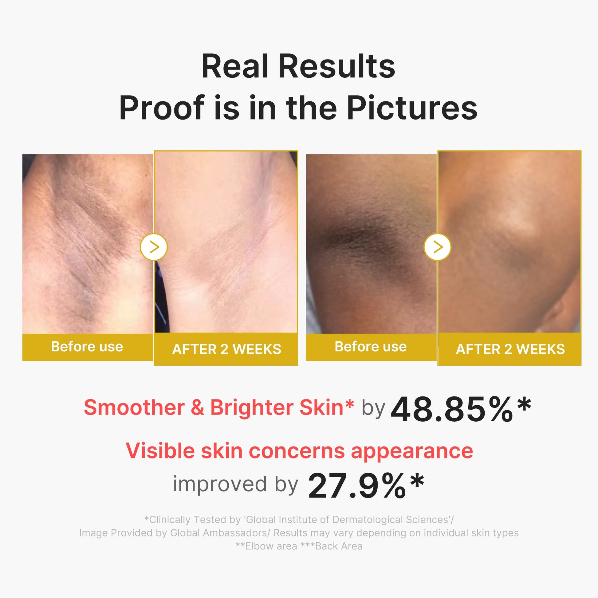 kojic-acid-turmeric-body-peel-shot-i6 02_72880cfc-382b-440b-8152-7e3dce87da2a.jpg