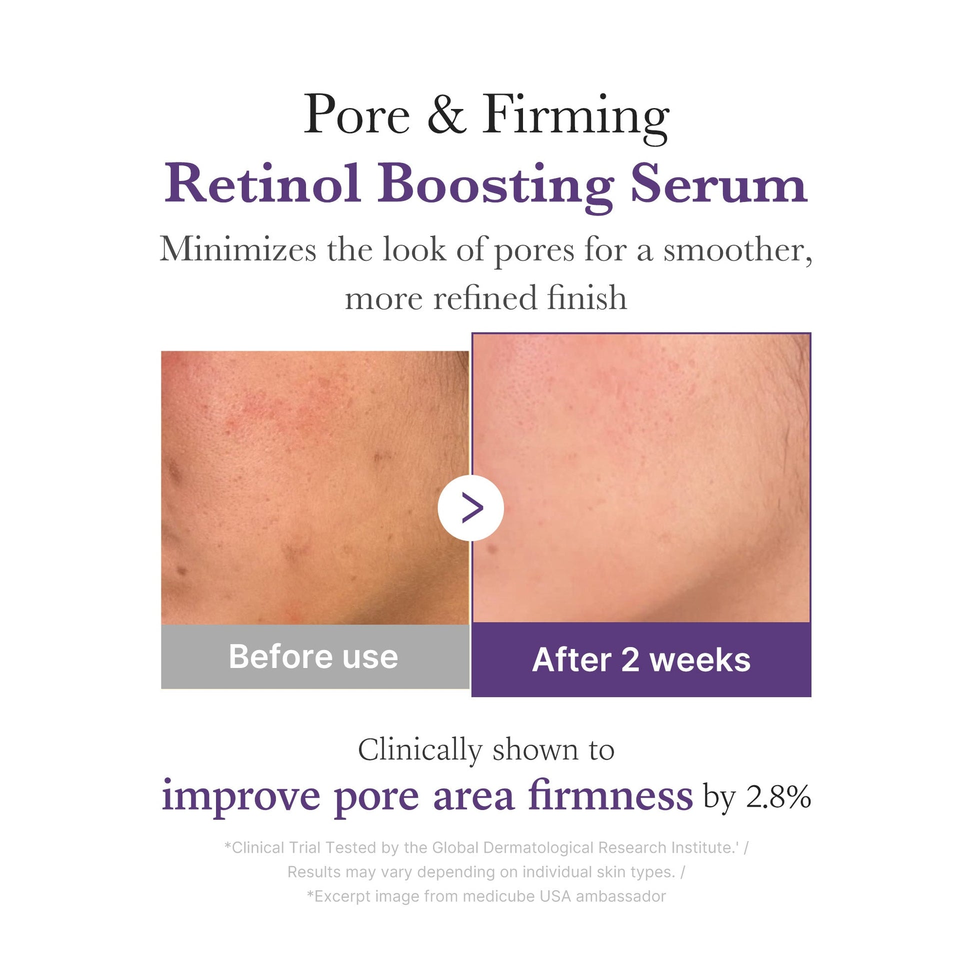 retinol-nmn-boosting-serum-m6 03_3510e7a5-5633-4a18-81ea-1389593bd517.jpg