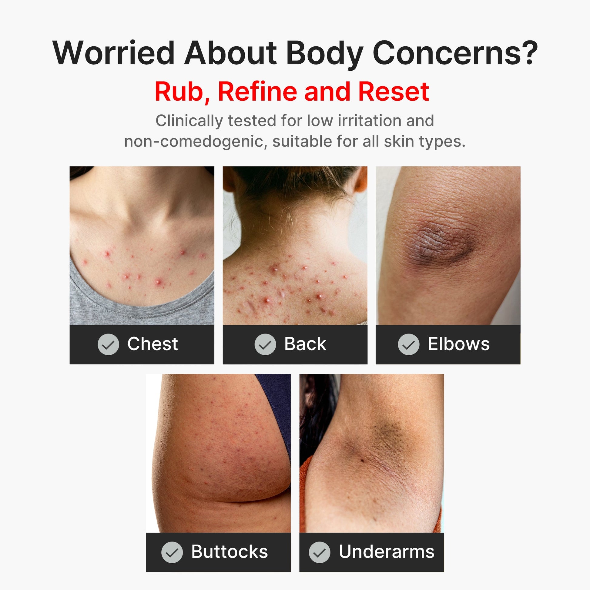 kojic-acid-turmeric-body-peel-shot-i6 04_8a7237f2-3ebf-401e-bd85-54841aeb3efc.jpg