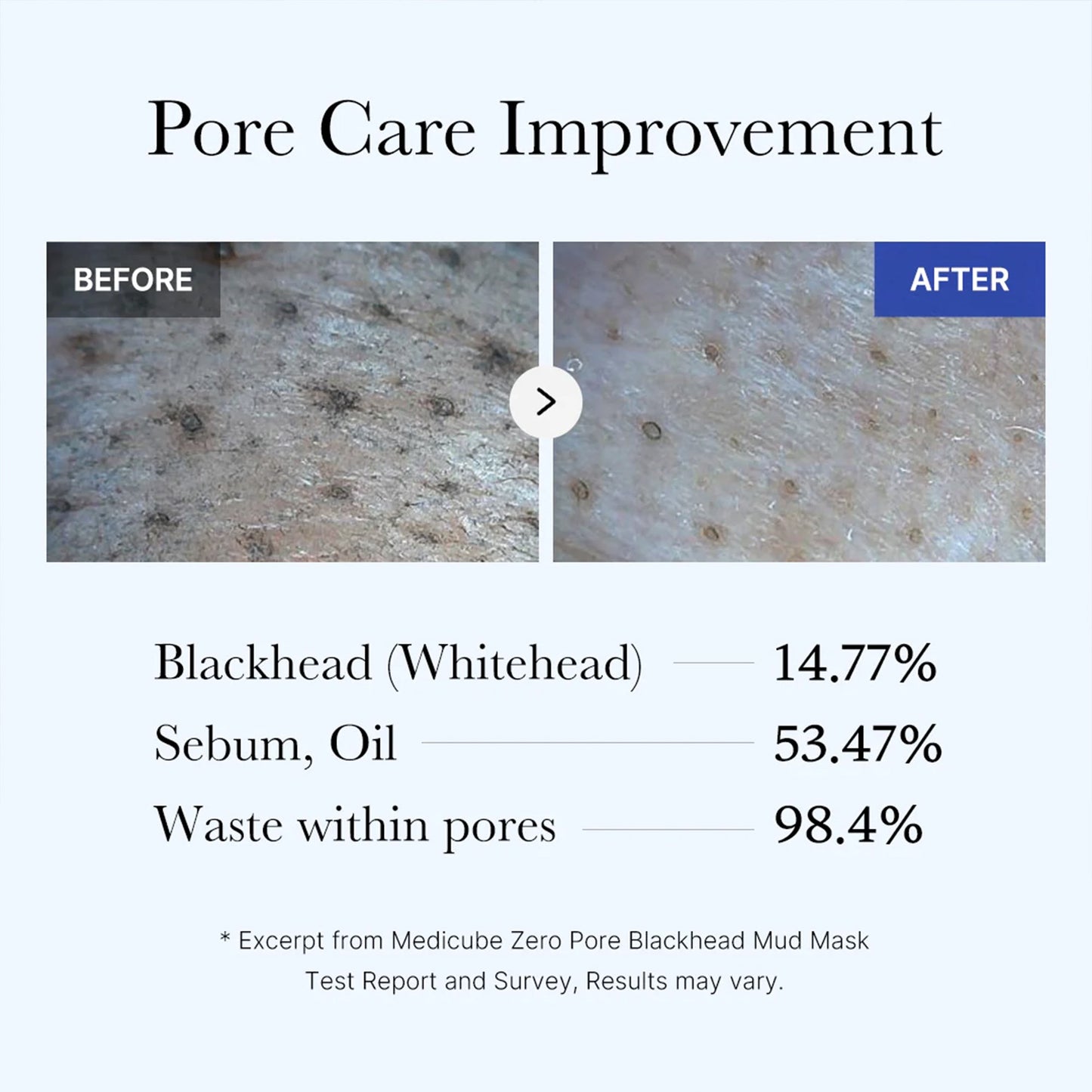 zero-pore-blackhead-mud-mask-d8 05_9362a158-c2b3-4525-acc0-631a2cfdea47.jpg