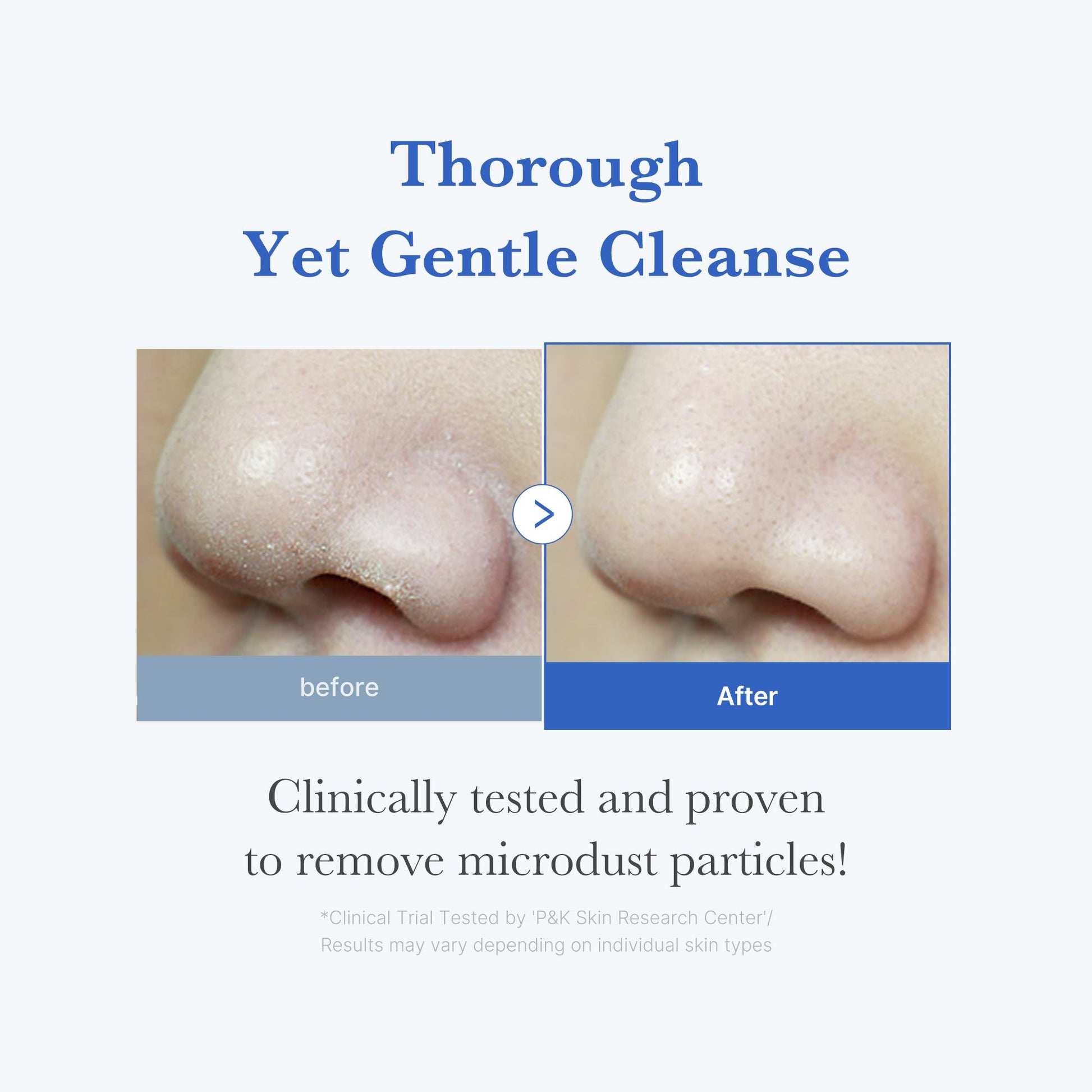 zero-foam-cleanser-m2 250702_ZeroCleanser3.jpg