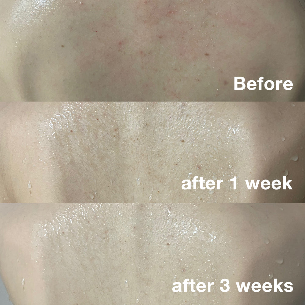 red-line-ultimate-face-and-body-care-set-u3 body_1195bc70-5acf-4559-b0cc-7d4509ae6629.jpg